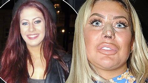 chloe ferry then and now.